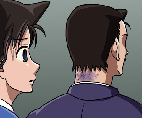【名探偵コナンおもしろ画像】蘭姉ちゃんが毛利小五郎の首の後ろを見て青ざめるおもしろいイラスト（笑）
